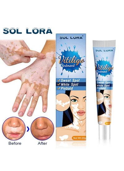 Buy Vitiligo Ointment, Vitiligo Care Cream for Skin Vitiligo, Psoriasis, Leukoplakia, Reduces White Spots, Improve Skin Pigmentation Regulating  20g in UAE