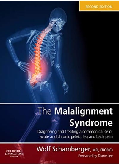 اشتري Malalignment Syndrome في الامارات