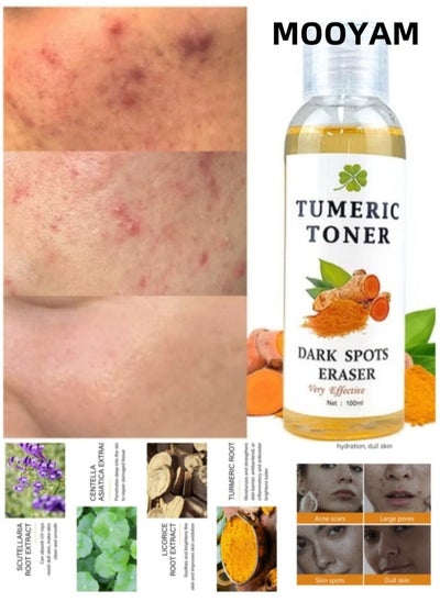 Buy Turmeric Dark Spot Correcting Toner, Facial Toner for Acne Prone Skin,Blemish Removing Facial Moisturizer  Hyperpigmentation Treatment，Anti-aging Moisturizing Essential Care Brighten Improve Fine Line in Saudi Arabia