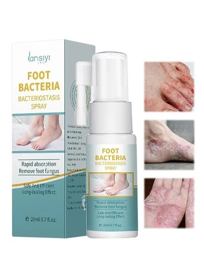 Buy Foot Beriberi Deodorization Bacteriostatic Spray 20ml, Foot Care Spray, Treatment Of Foot Itching And Foot Odor, Deodorant And Antibacterial Foot Odor Spray To Relieve Odor Sweat Feet in UAE