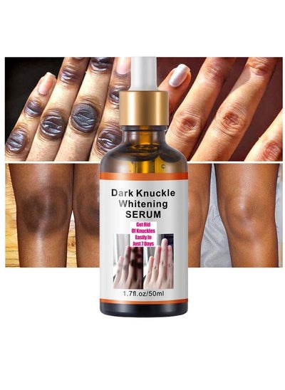 Buy Dark Knuckle Whitening Serum 7 days Treatment for Dark Spots in Hand and Feet Knuckles Exfoliating Improves Dullness Powerful Whitening Effect for Men and Women 50ml in UAE