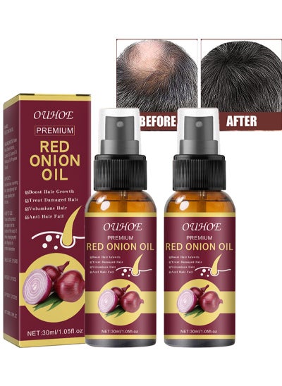 Buy 2Pcs Premium Red Onion Hair Oil，Onion Thickening Spray，Hair Oil with Onion Extract Onion Hair Growth Products for Men and Women Rapid Growth Anti-Hair Loss in Saudi Arabia