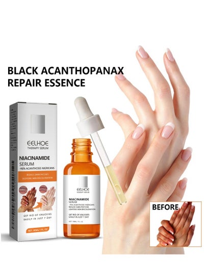 Buy Black Echinoderm Repair Essence Brighten Skin Tone Repair For Hand and Feet in UAE