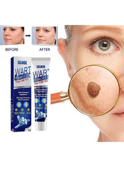 Buy Wart Removal Ointment Natural Herbal Wart Remover Treatment Skin Repair Cream Against Moles Warts Use On Any Parts Of Body 20g in Saudi Arabia