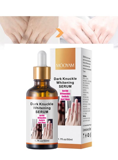 Buy Whitening Serum Hand Knuckle Glow Serum, Restoring Hand Treatment, Moisturizing, Exfoliates and Reduces Unbalanced Pigmentation, for Removing Dark Knuckle Elbow, Brighter, Firmer Skin in UAE