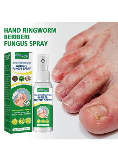 Buy Hand Ringworm BeriBeri Fungus Spray, Anti-Fungi Treatment For Feet Itchy, Sweating, Peeling And Blisters, Natural Ingredients Foot Fungi Spray For Tinea Pedis, Inflamed, Feet Smelly 30ML in UAE