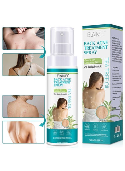 Buy Back Acne Treatment Spray, 2% Salicylic Acid And Tea Tree Oil Spray, Body Acne Treatment With Herbal Formula, Body Acne Spray, Tea Tree Oil Spray, Back Acne Solution in UAE