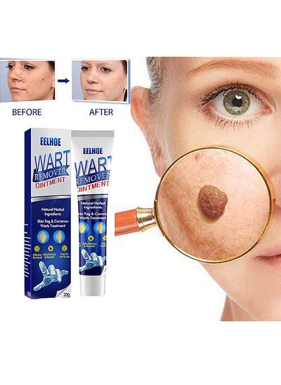 Buy Wart Removal Ointment Natural Herbal Wart Remover Treatment Skin Repair Cream Against Moles Warts Use On Any Parts Of Body 20g in UAE