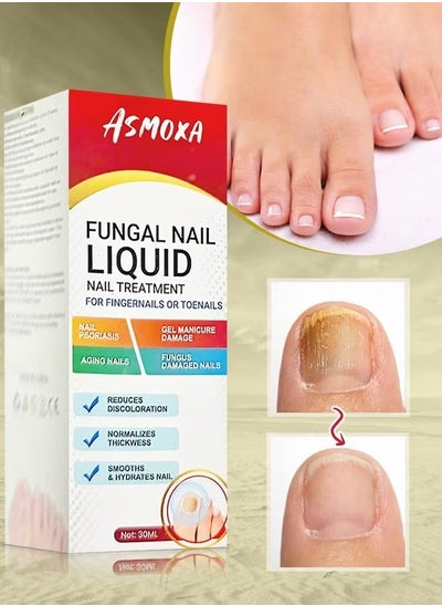 Buy Fungal Nail Treatment Liquid Nail Fungus Treatment for Toenails & Fingernails Fungal Nail Renewal Anti Fungus Nail Repair Smooth & Hydrates Nail Reduce Discoloration 30ml in UAE