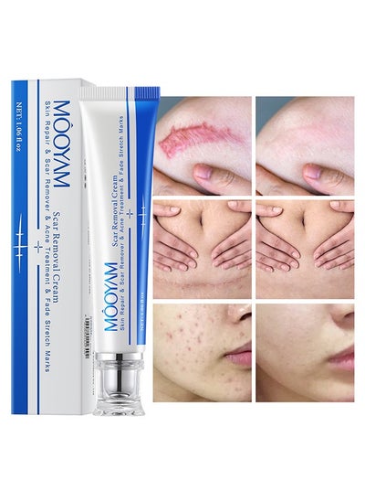 Buy Scar Removal Cream-Skin Repairing Cream Fade Scars/Stretch Marks/Acne Treatment, Improve Scar Skin, Deeply Moisturizes Skin-30ml in UAE