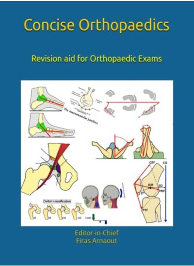 اشتري Concise Orthopaedic Notes Revision Aid For Frcs Ebot Sicot And Board Examinations by Arnaout Frcs, Firas Paperback في الامارات