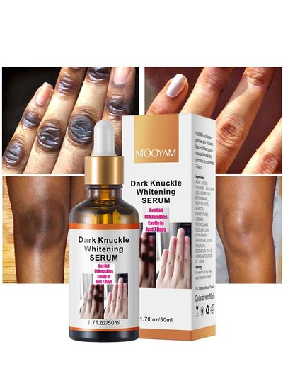 Buy Dark Knuckle Whitening Serum 7 days Treatment for Dark Spots in Hand and Feet Knuckles Exfoliating Improves Dullness Powerful Whitening Effect for Men and Women 50ml in UAE