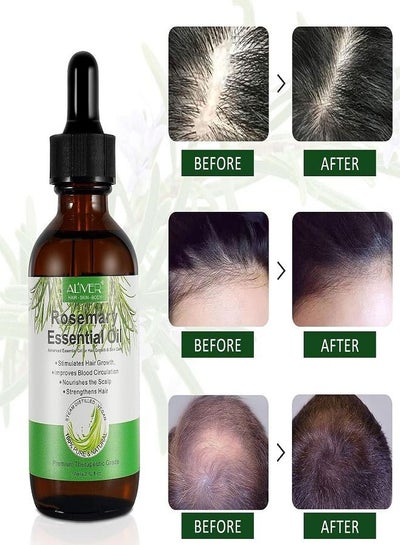 Buy Rosemary Essential Oil for Hair Growth Treatment Strengthens Hair Nourishes Scalp Light Weight Non Greasy Improves Scalp Circulation for Men And Women 60ml in Saudi Arabia