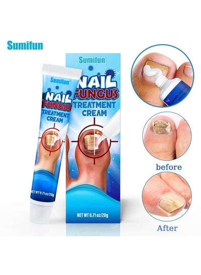 Buy Nail Fungus Treatment Cream, Bad Nail Care Ointment, Nail Fungus Treatment, Nail Growth and Repair, Nail Treatment Repair Cream  20g in UAE