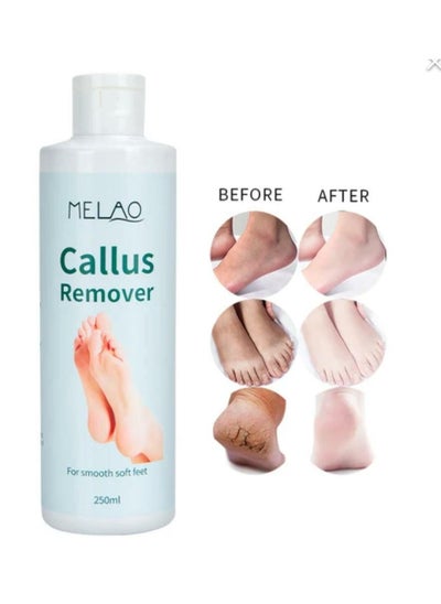 Buy Callus Remover For Smooth Soft Feet 250ml in Saudi Arabia