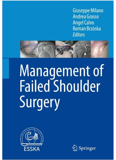 Buy Management of Failed Shoulder Surgery in UAE