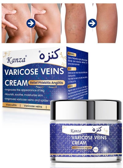 Buy Varicose Veins Cream 50g Relief Phlebitis Angiitis 100% Natural Ingredients Added Eliminate the Appearance of Varicose Veins Repair Soothing Leg Cream for Healing Varicose Veins for Men & Women in UAE