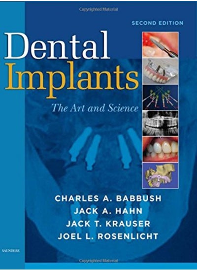 اشتري Dental Implants by Charles A. Babbush (Director, ClearChoice Dental Implant Center; Clinical Professor, Department of O Hardcover في الامارات