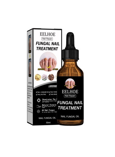 Buy Fungal Nail Treatment Suitable for Repairing Onychomycosis and Dead Skin and Moisturizing Nails in Saudi Arabia