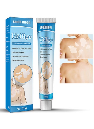 Buy VitiligoTreatment Ointment, Skin Vitiligo Treatment, Vitiligo Care Cream Reduces White Spots And Improves Skin Pigmentation 20G in UAE