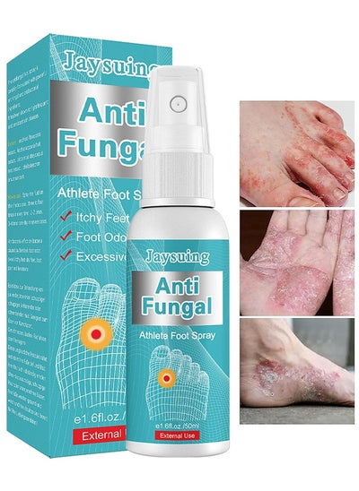 Buy Anti Fungal Athletes Foot Treatment Spray, Anti-Fungi Treatment For Feet Itchy, Sweating, Peeling And Blisters, Natural Ingredients Foot Fungi Spray For Tinea Pedis 50ML in Saudi Arabia