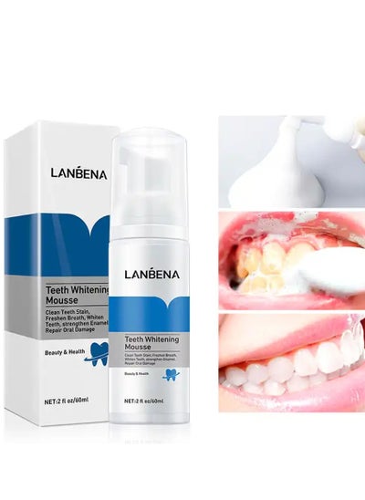 اشتري LANBENA 60ml Teeth Whitening Essence with Swabs Teeth Whitening Whitening Effect Serum Remove Plaque Stain Oral Cleaner في الامارات