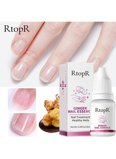 Buy Ginger Nail Repair Essence 10ml, Has Antifungal And Antibacterial Properties, Relieves Nail Infections, And Promotes Nail Healing, Nail Treatment Healthy Nails in Saudi Arabia