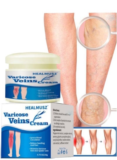 Buy Varicose Vein Cream for Legs Reduces Spider Veins and Heaviness Anti Varicose Vein Soothing Leg Cream to Improve Blood Circulation Enhance Capillary Varicose Vein Repair Cream 20g in UAE