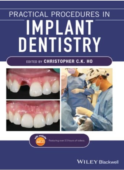 اشتري Practical Procedures In Implant Dentistry by Ho, CCK Paperback في الامارات