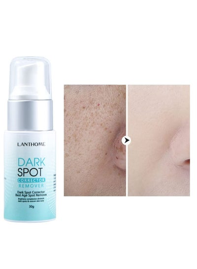 Buy 30g of Professional Dark Spots Corrector & Remover For Both Men And Women in UAE