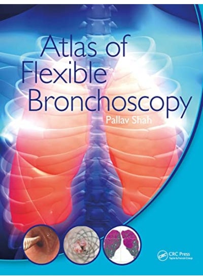 Buy Atlas Of Flexible Bronchoscopy in UAE