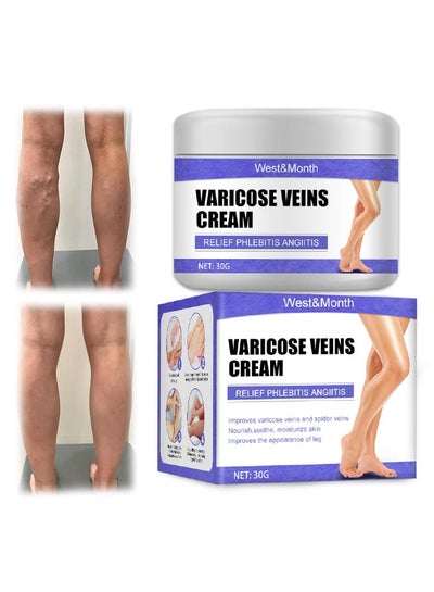 Buy Varicose Veins Cream Eliminate And Spider Veins, Varicose Veins Relief Cream, Improve Blood Circulation, Soothes Tired Legs in Saudi Arabia