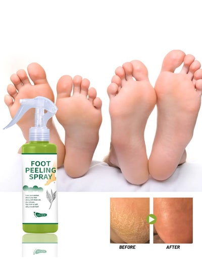 Buy Foot Peel Spray,Foot Exfoliating Spray, Foot Peeling Spray that Remove Dead Skin within Seconds,Hydrating Nourish Peel Off Spray (Green Tea) in Saudi Arabia