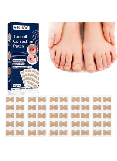 Buy 50 Pieces Ingrown Toenail Correction Stickers Toenail Corrector Patch Glue free Ingrown Toenail Corrector Strips Toe Nail Correction File Patches Relieve Nail Groove Unisex in Saudi Arabia