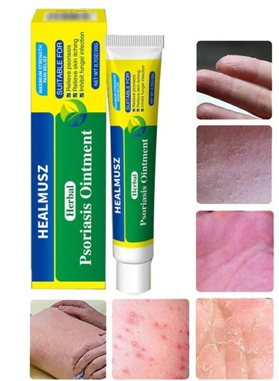 Buy Herbal Psoriasis Ointment Advanced Psoriasis Treatment Cream Antifungal Cream Maximum Strength Pain Relief Relieve Psoriasis Skin Itching and Inhibit Fungal Infection Psoriasis Treatment Cream 20g in UAE