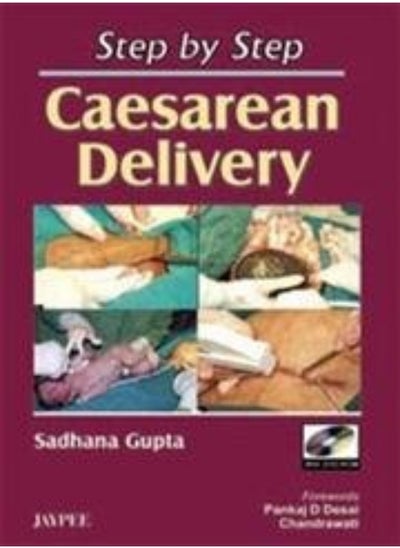 اشتري Step by Step Caesarean Delivery with DVD-ROM في الامارات