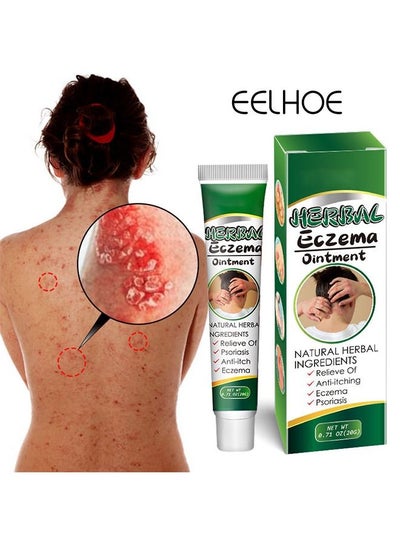 Buy Treatment Psoriasis Eczema Cream Antibacterial Antipruritic Dermatitis Herbal Ointment Anti-itch Medical Plaster in Saudi Arabia