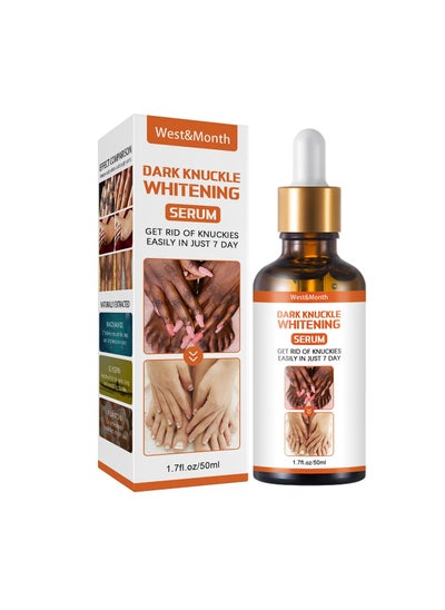 Buy Acanthosis Nigricans Therapy Oil, 50ml Strong Dark Knuckle Whitening Serum, Skin Brightening Dark Knuckles Remover Oil , Knuckle Whitening Cream Corrector For Knuckle Finger Elbow And Knee in UAE