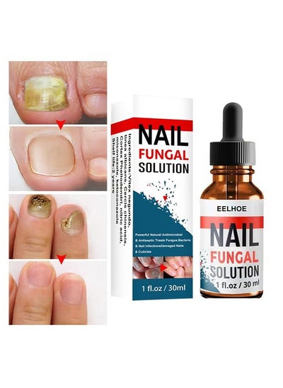 اشتري Nail Repair Solution Hand and Foot Nail Fungus Care Repairs Nail Fungus Fluid to Thicken Soft Nails Onychomycosis Care في السعودية