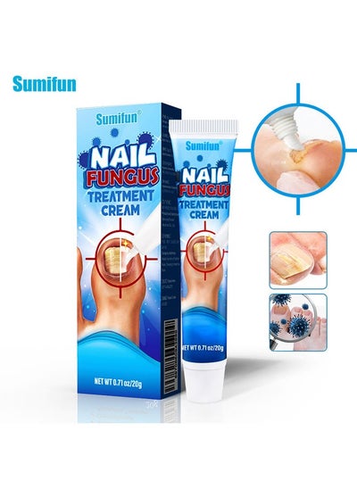 Buy Nail Fungus Treatment Cream 20g, Bad Nail Care Ointment, Nail Fungus Treatment, Nail Growth and Repair, Nail Treatment Repair Cream in UAE