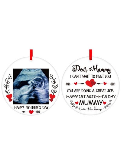 Buy Ultrasound Picture Frame Mothers Day Ornaments 2023 Baby Sonogram Photo Frame Ornament For Dad Mom To Be Pregnant Expecting Parents Mothers Day Gifts Bump First Time Mom Gifts in UAE
