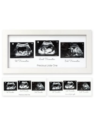 اشتري Sonogram Picture Frame Trio Ultrasound Picture Frames For Mom To Be Gift Baby Ultrasound Frame For Pregnancy Announcements Baby Nursery Decor Pregnant Mom Gifts (Alpine White) في الامارات