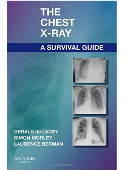 Buy The Chest Xray A Survival Guide By de Lacey, Gerald, MA, FRCR (Consultant Radiologist to and formerly Consult Paperback in UAE