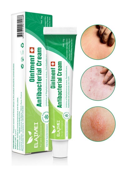 Buy Antibacterial Ointment Cream, Mosquito Bite Itching Relieve Itching Skin Topical Herbal, Itch And Rash Ointment, Anti Itch Cream Extra Strength For Itchy Skin Relief, Rash Cream 15G in UAE