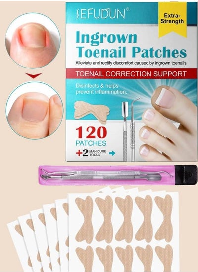 اشتري 120 pcs Ingrown Toenail Corrector Patches with 2 Manicure Tools Glue Free Ingrown Toenail Corrector Strips Ingrown Toenail Correction Stickers for Toenail Repair Toenail File Patches في الامارات