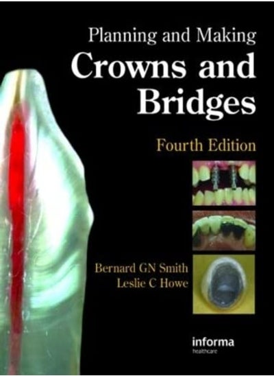 Buy Planning and Making Crowns and Bridges in UAE