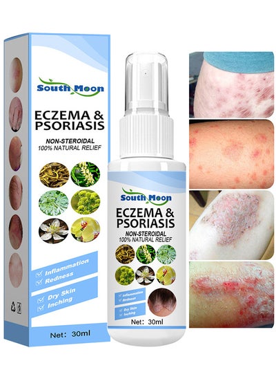 Buy Natural Chinese Herbal Eczema And Psoriasis Spray, Dermatitis And Eczema Pruritus Psoriasis Spray, Say Goodbye To Scaly Skin, Eczema Relief Spray, Stops Burning And Itching 30ML in UAE