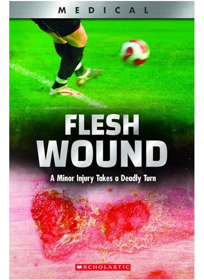 Buy Flesh Wound (Xbooks): A Minor Injury Takes a Deadly Turn in UAE