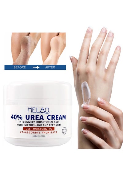 اشتري 40٪ Urea Cream - مكثف يرطب ويغذي بشرة اليدين والقدمين ، وينعم الكالس للكعب الجاف المتشقق المرفقين 150 جرام في الامارات