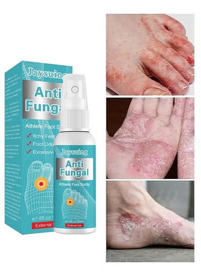 Buy Anti Fungal Athletes Foot Spray-Anti Fungi Treatment For Feet Itchy, Sweating, Peeling And Blisters, Natural Ingredients Foot Fungi Spray For Tinea Pedis 50ML in UAE